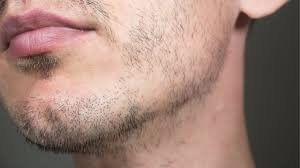 poucos pelos na barba
